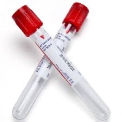 Red Top Vacutainer